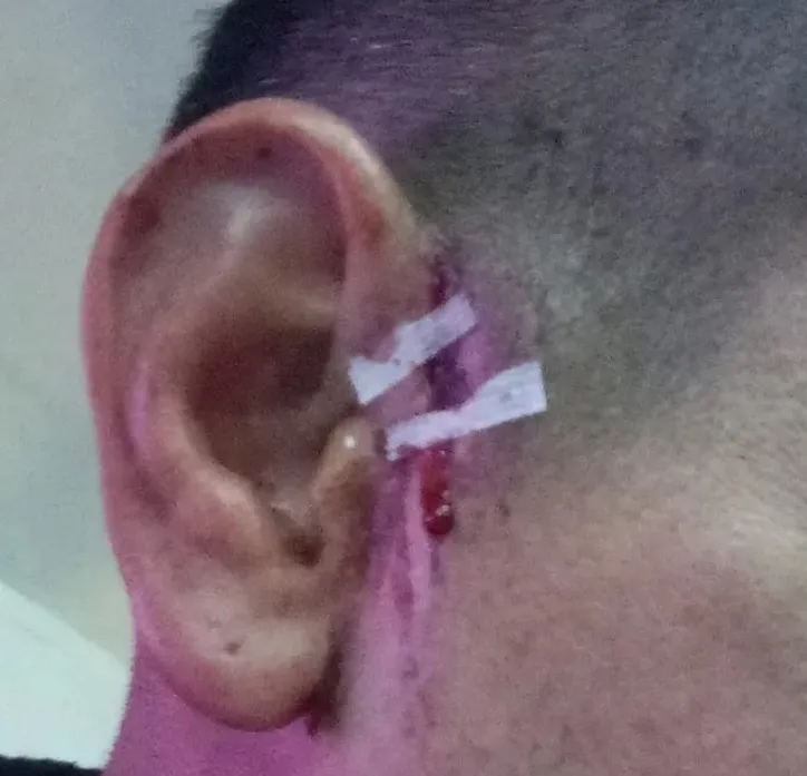 agresion liga santafesina