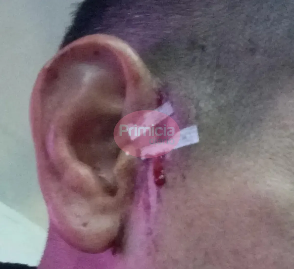 agresion liga santafesina (1)